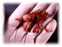 11-week Aborted Fetus